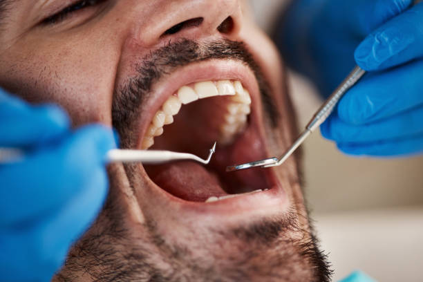 Best Cracked Tooth Emergency Dentist  in Frent Hills, MO
